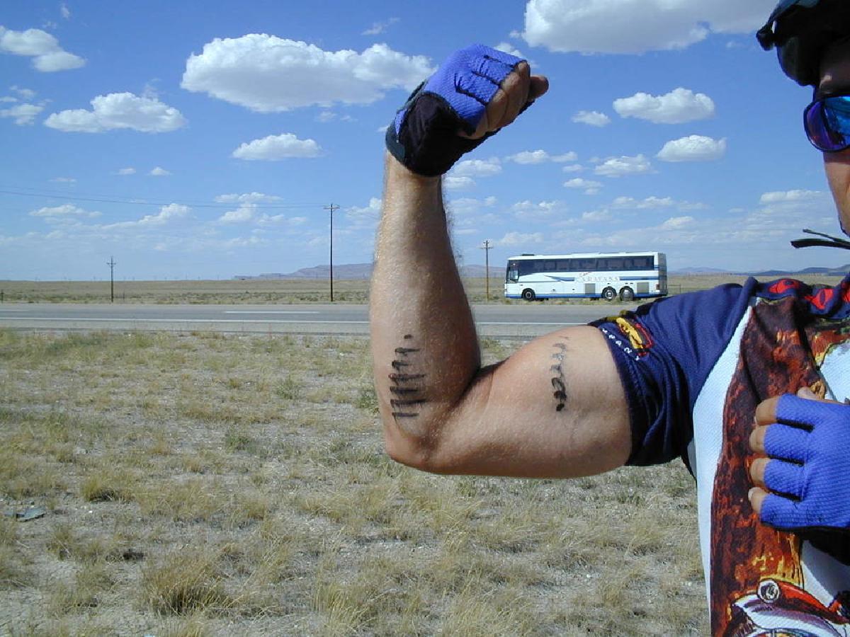 Arm after hopping a fence