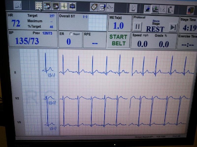 gallery/ekgTest_001.jpg
