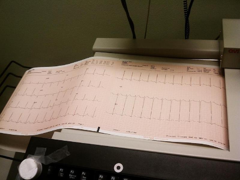 gallery/ekgTest_002.jpg